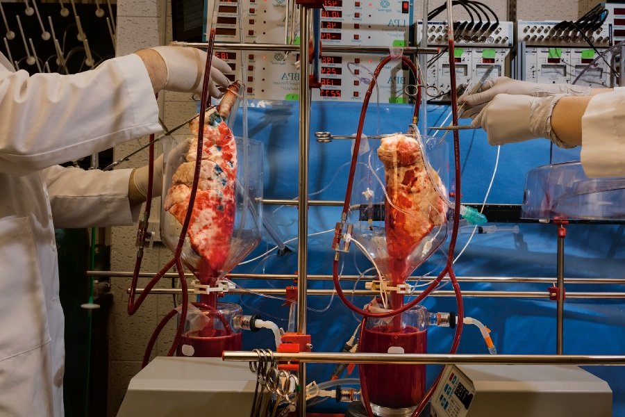 चीन में सर्जनों ने किया सुअर से इंसान में फेफड़े का सफल प्रत्यारोपण